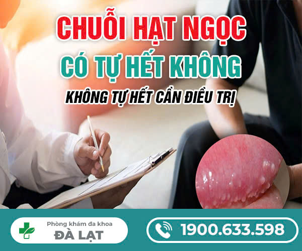 Hình ảnh minh họa